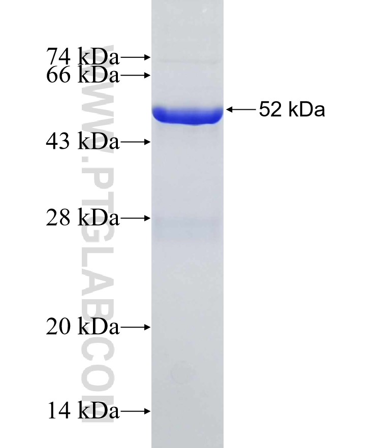 EXOSC4 fusion protein Ag7595 SDS-PAGE