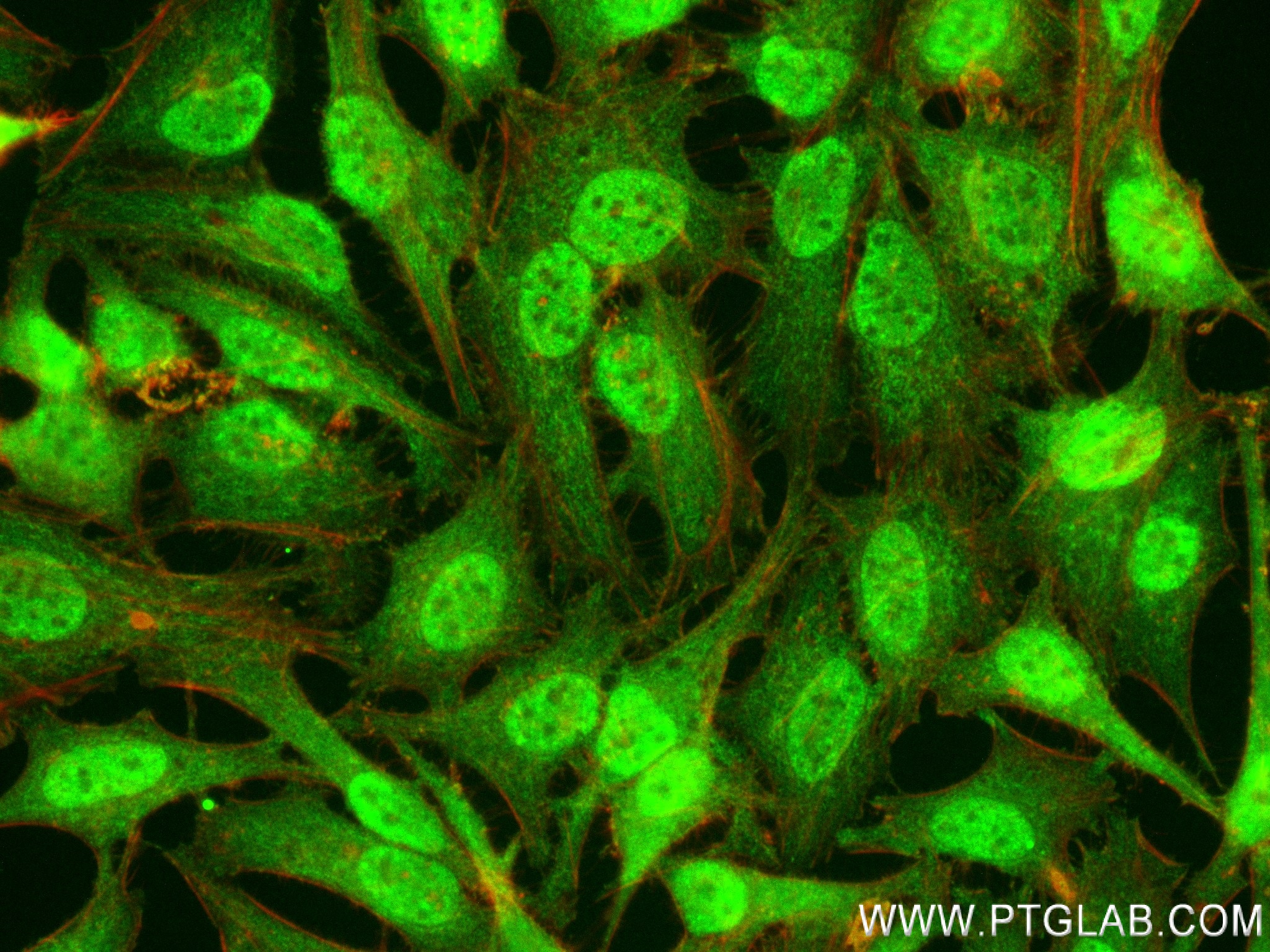 IF Staining of HeLa using 84346-2-RR