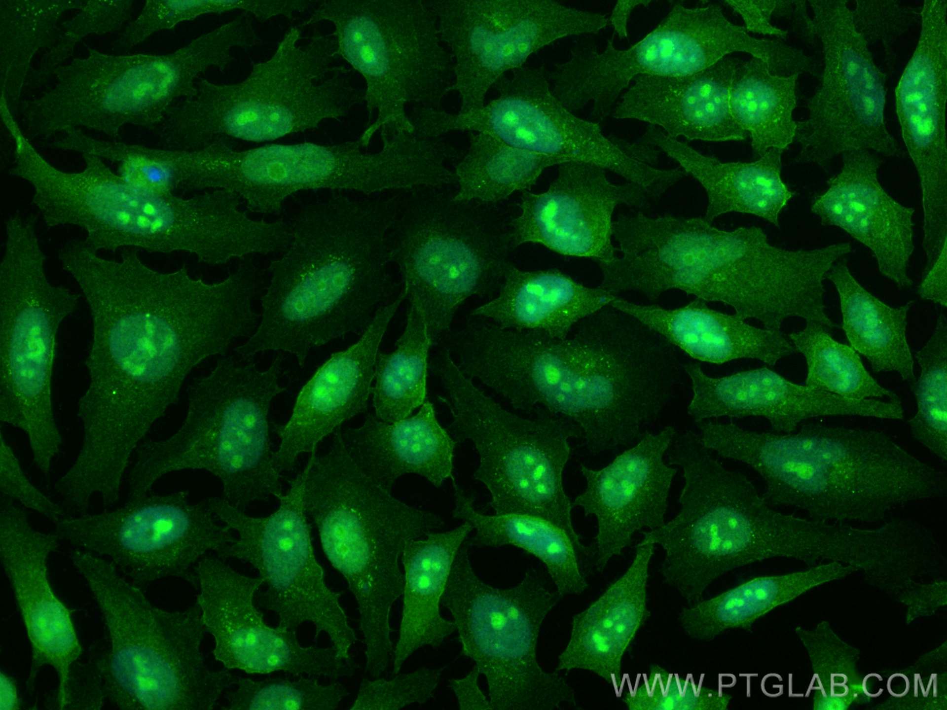 IF Staining of HeLa using 25292-1-AP