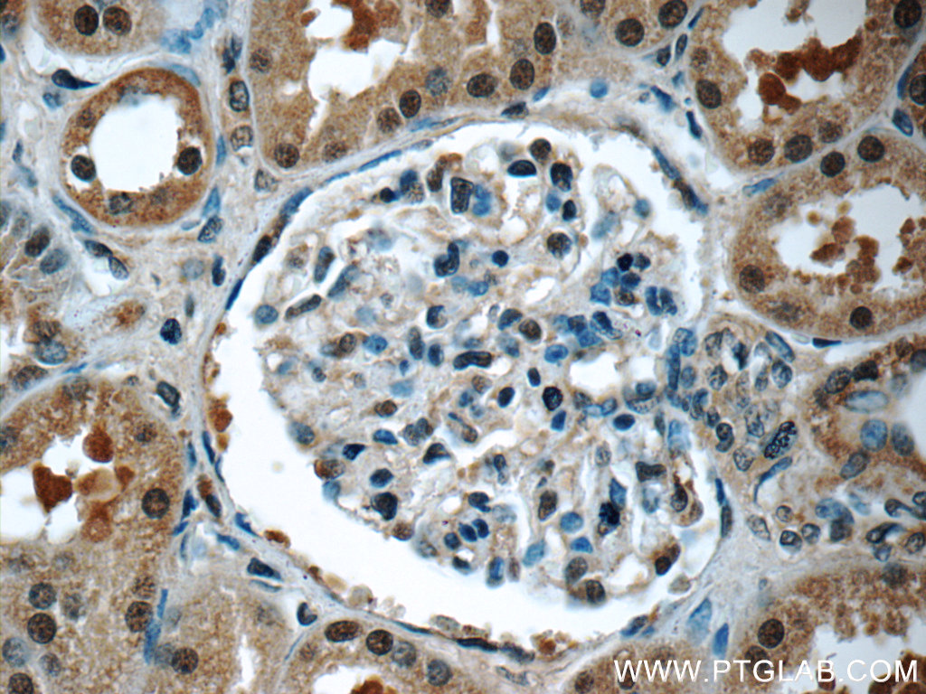 IHC staining of human kidney using 25292-1-AP