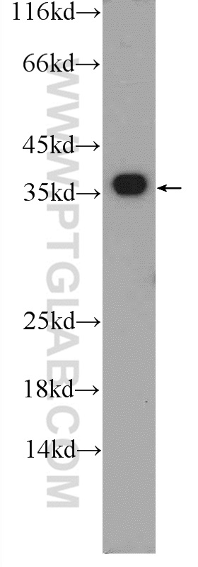 WB analysis of MCF-7 using 25292-1-AP