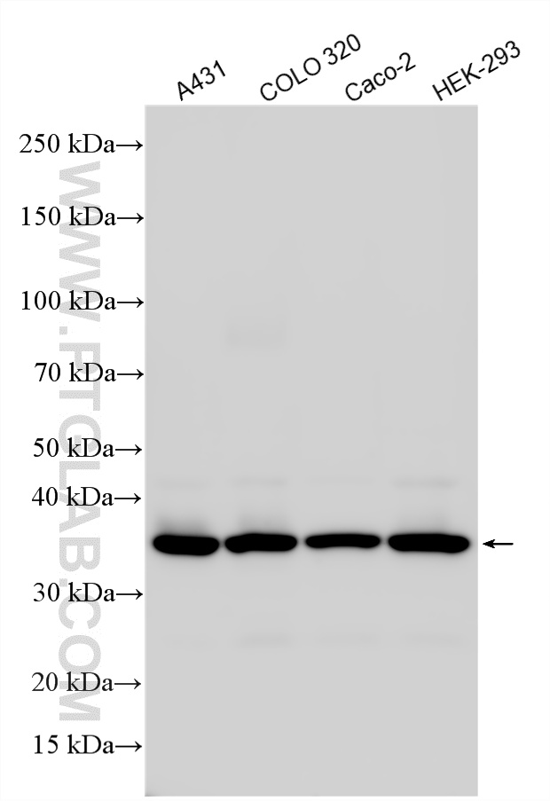 Various lysates were subjected to SDS PAGE followed by western blot with 25292-1-AP (EXOSC7 antibody) at dilution of 1:15000 incubated at room temperature for 1.5 hours. WB analysis using 25292-1-AP