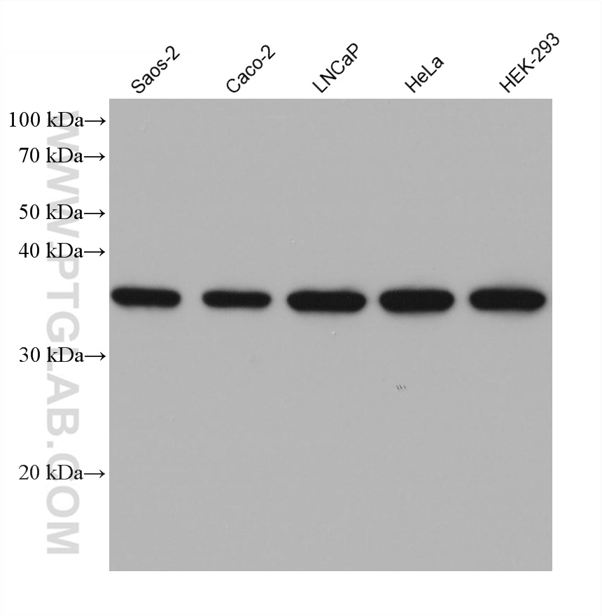 WB analysis using 68456-1-Ig