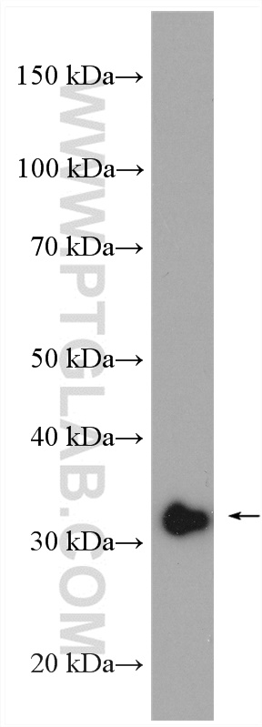 WB analysis of HEK-293 using 11979-1-AP