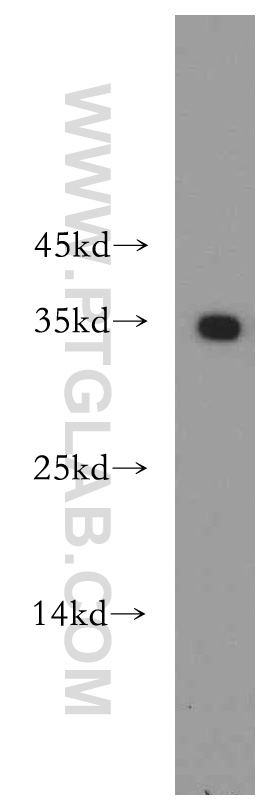 EXOSC8 Polyclonal antibody