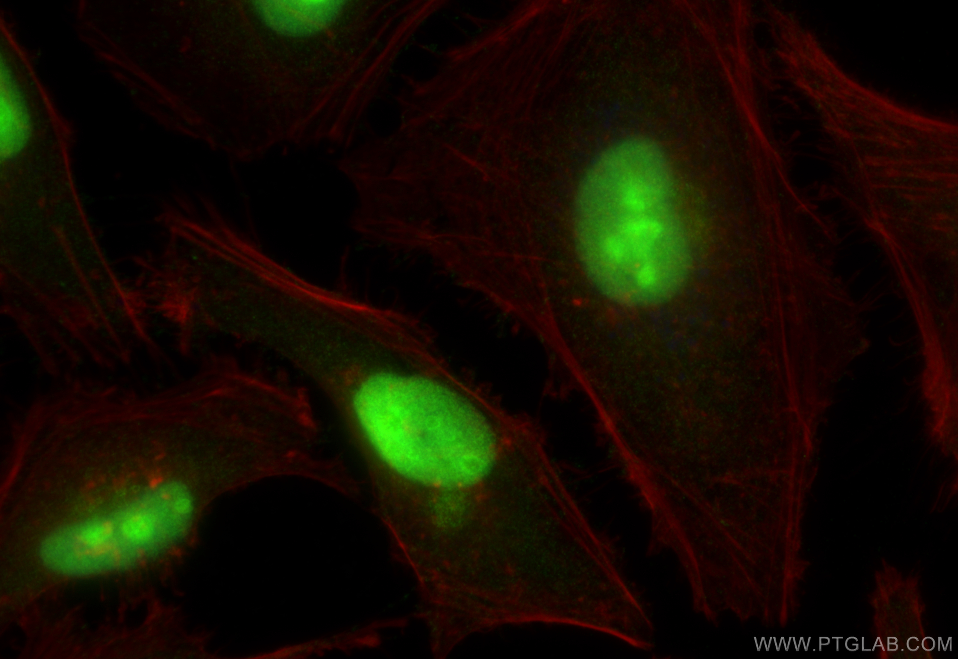 IF Staining of HeLa using 24470-1-AP