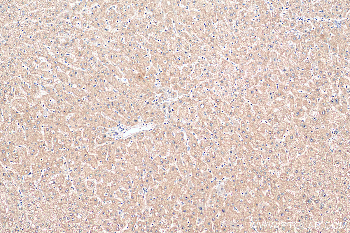 IHC staining of human liver using 22199-1-AP
