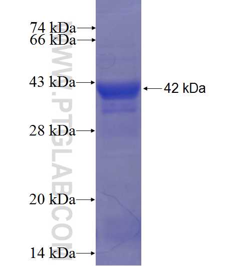EXTL1 fusion protein Ag6305 SDS-PAGE EXTL1 fusion protein Ag6305 SDS-PAGE