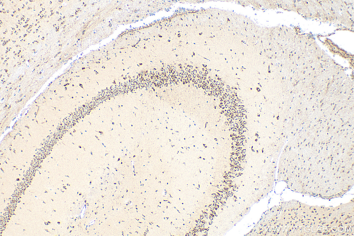 IHC staining of mouse brain using 12828-1-AP