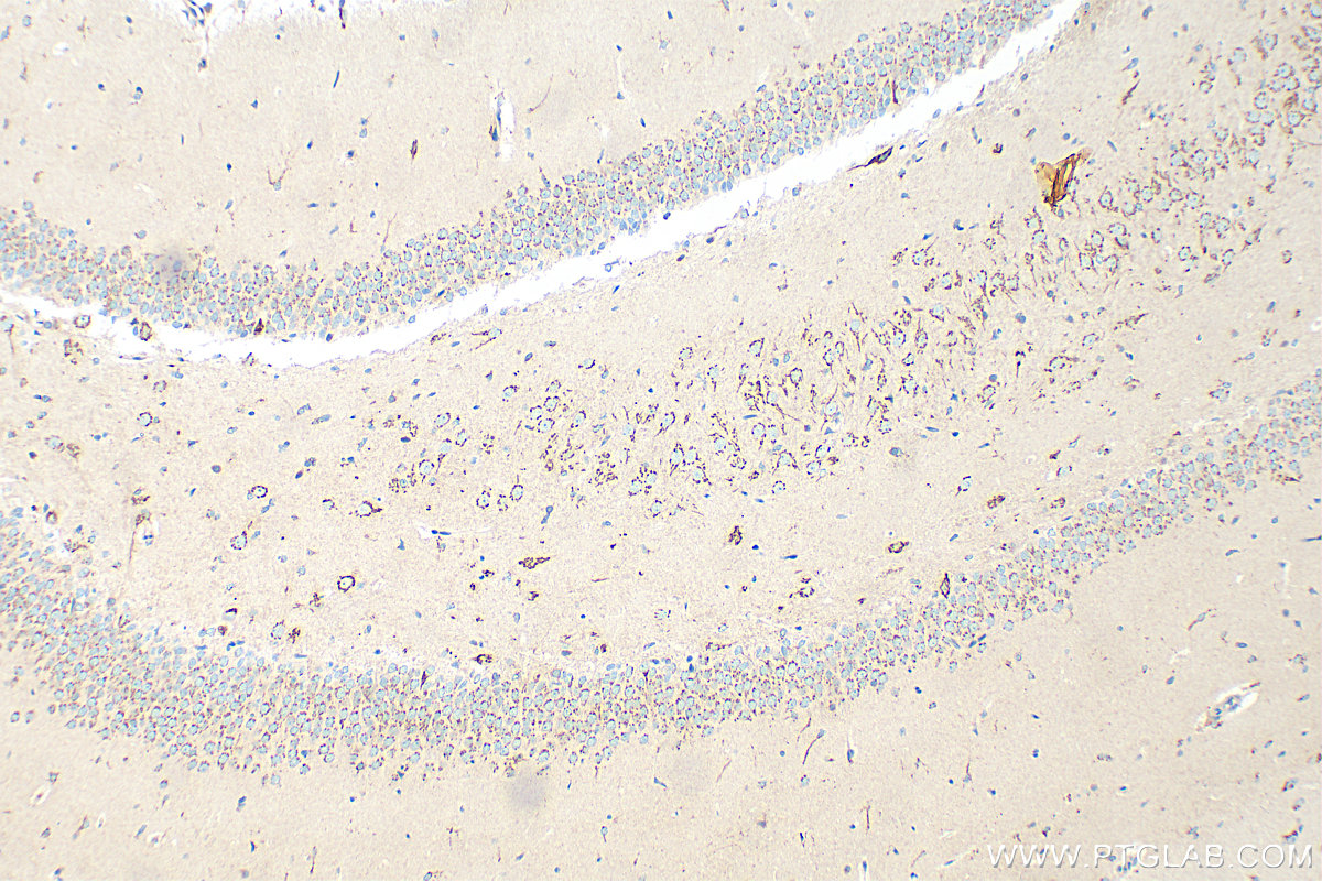 IHC staining of rat brain using 12828-1-AP