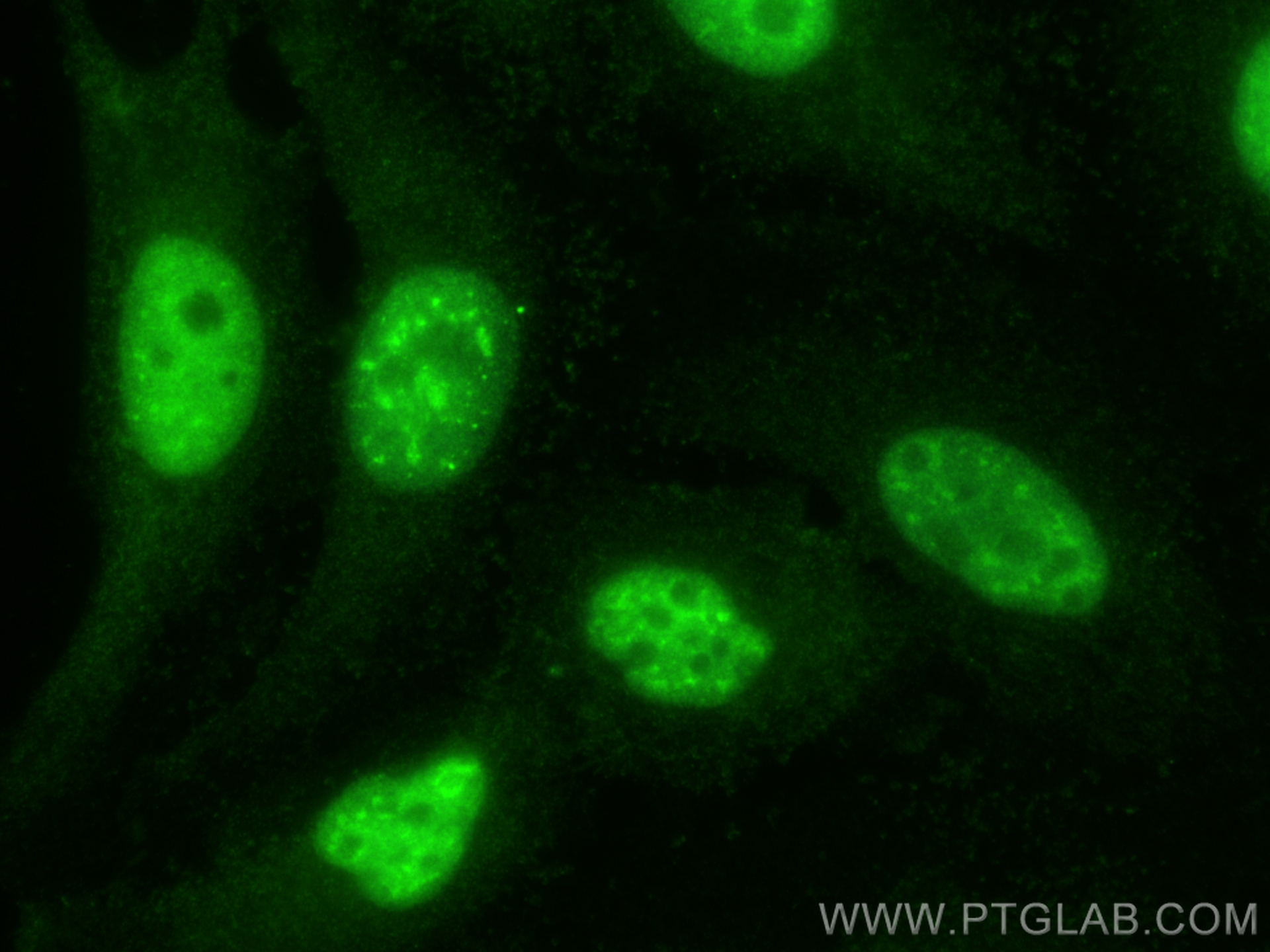 IF Staining of HeLa using 21196-1-AP