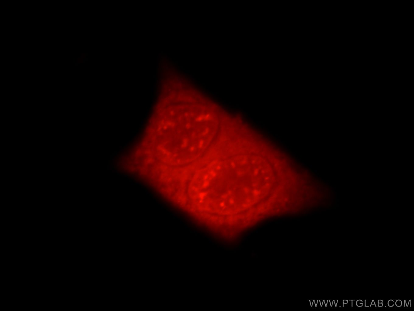 IF Staining of HeLa using 21196-1-AP