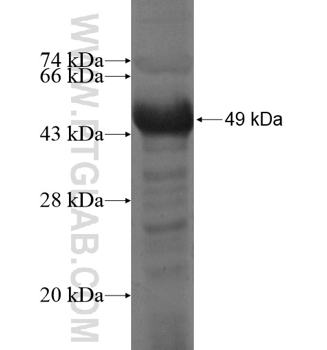 EYA3 fusion protein Ag15307 SDS-PAGE EYA3 fusion protein Ag15307 SDS-PAGE