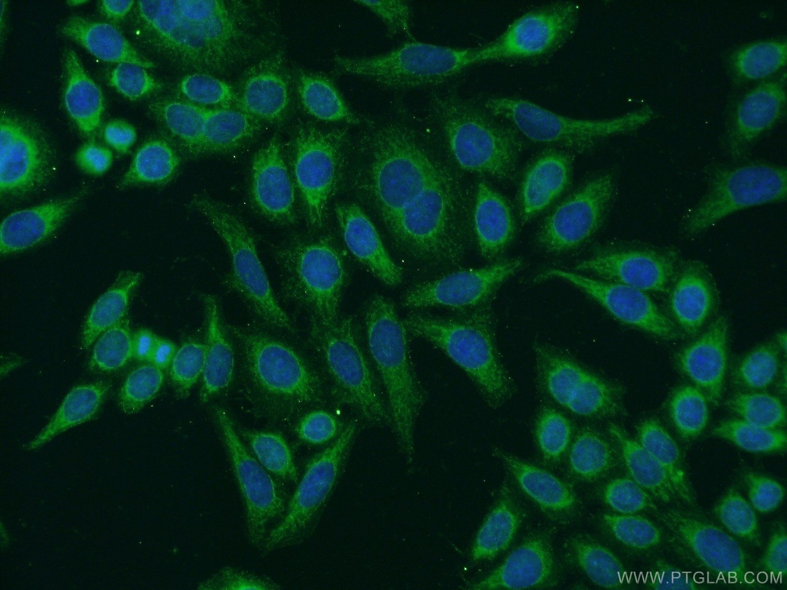 IF Staining of HeLa using 24691-1-AP