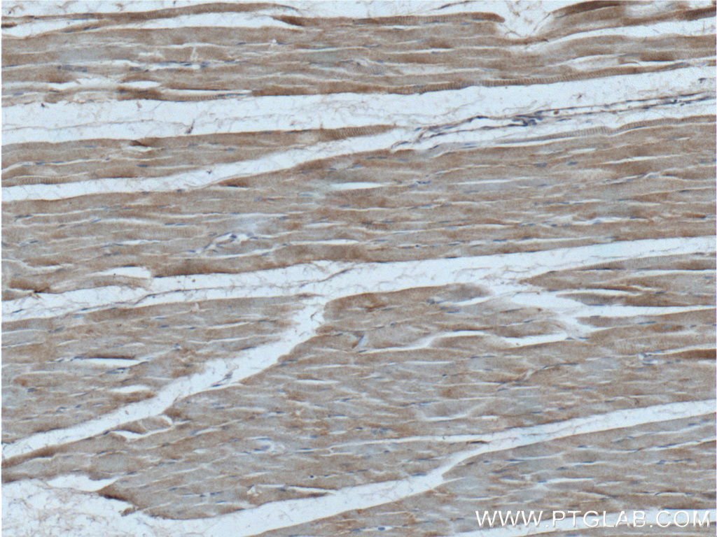 IHC staining of human skeletal muscle using 24691-1-AP