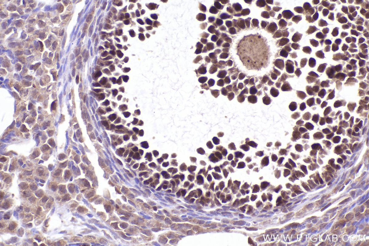IHC staining of mouse ovary using 21800-1-AP