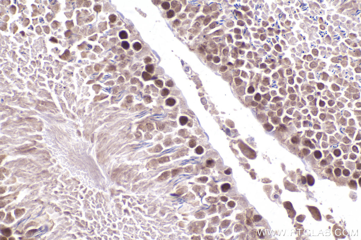 IHC staining of rat testis using 21800-1-AP