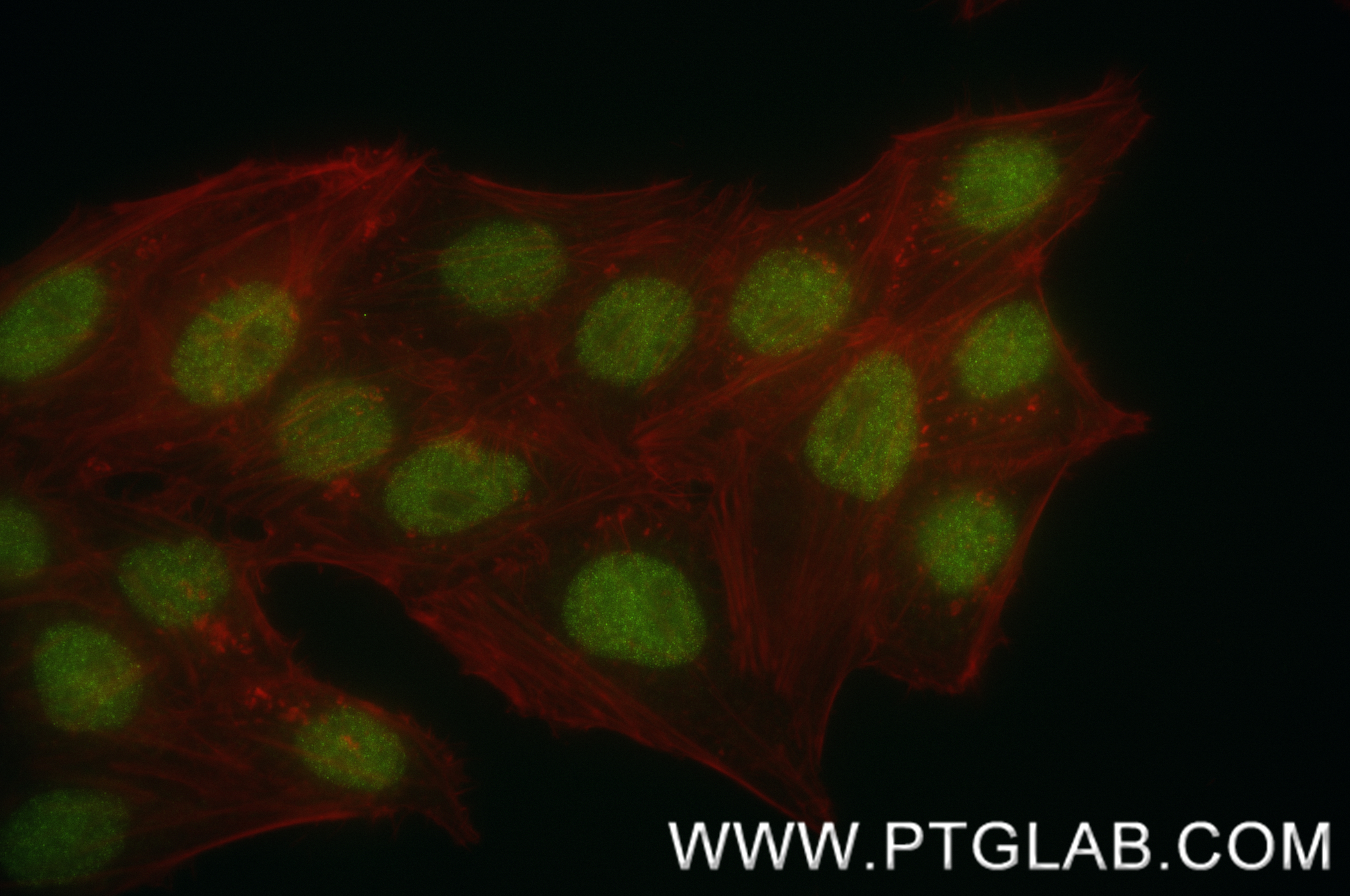 IF Staining of HepG2 using 84824-3-RR (same clone as 84824-3-PBS)
