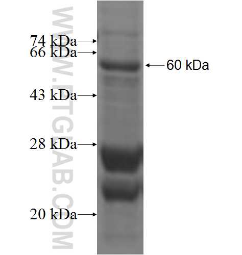 EZH2 fusion protein Ag2799 SDS-PAGE EZH2 fusion protein Ag2799 SDS-PAGE