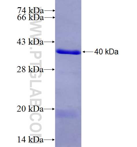 EZH2 fusion protein Ag9141 SDS-PAGE EZH2 fusion protein Ag9141 SDS-PAGE