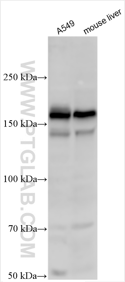 WB analysis using 30847-1-AP