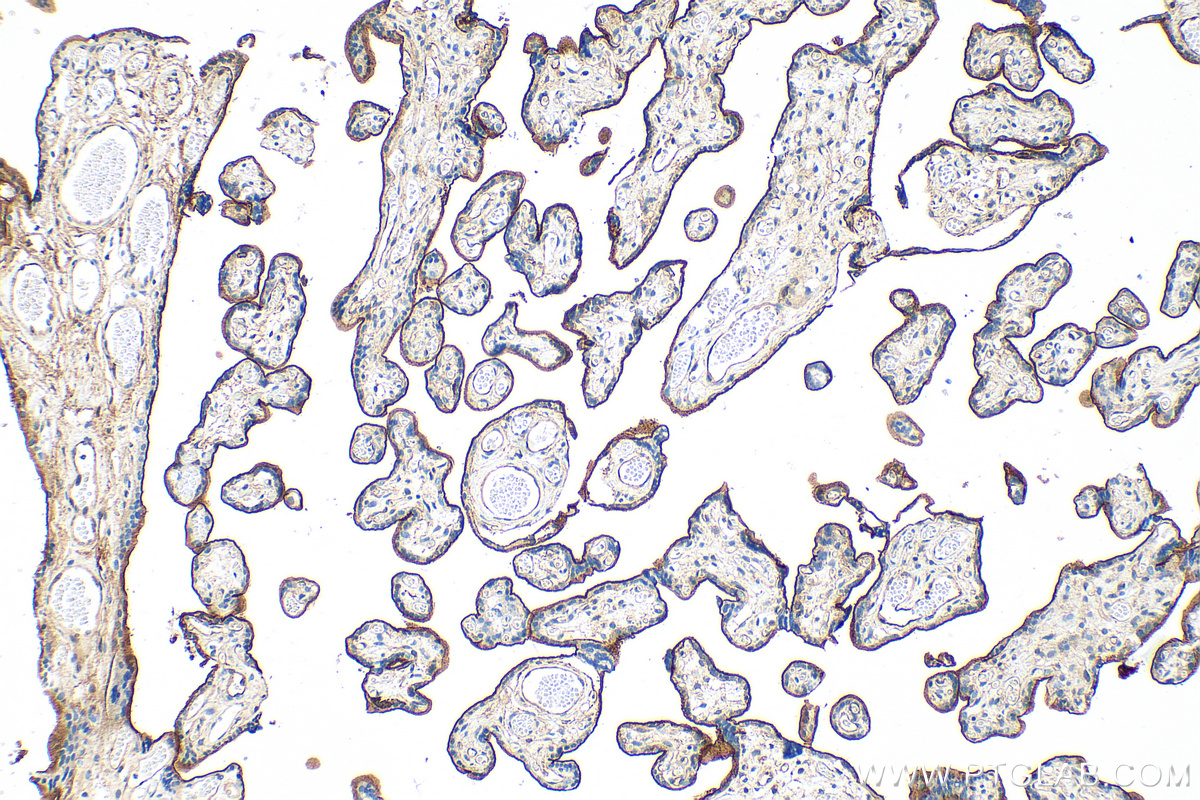 Endoglin/CD105