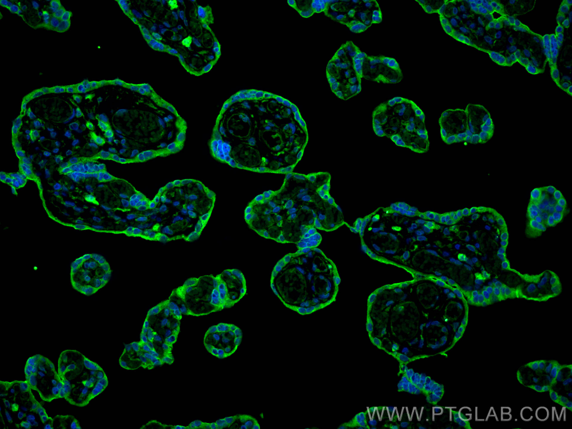 IF Staining of human placenta using 67075-1-Ig