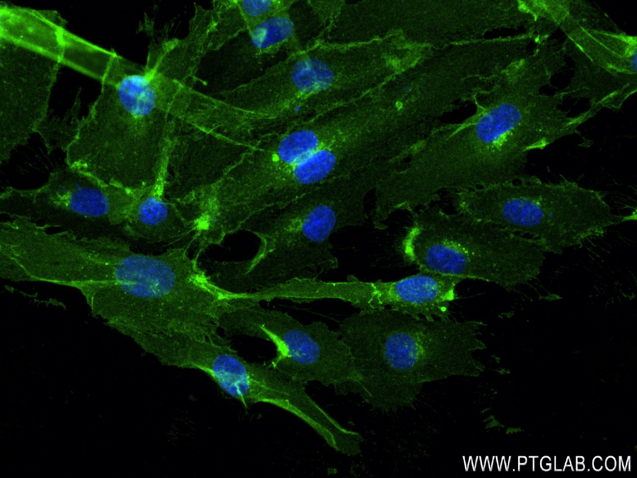 IF Staining of HUVEC using 82993-5-RR (same clone as 82993-5-PBS)