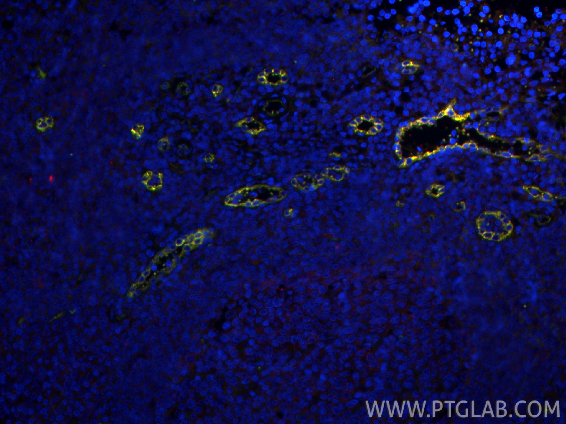 IF Staining of human tonsillitis using 82993-6-RR (same clone as 82993-6-PBS) IF Staining of human tonsillitis using 82993-6-RR (same clone as 82993-6-PBS)