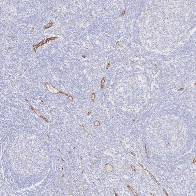 IHC staining of human tonsillitis using 82993-6-RR
