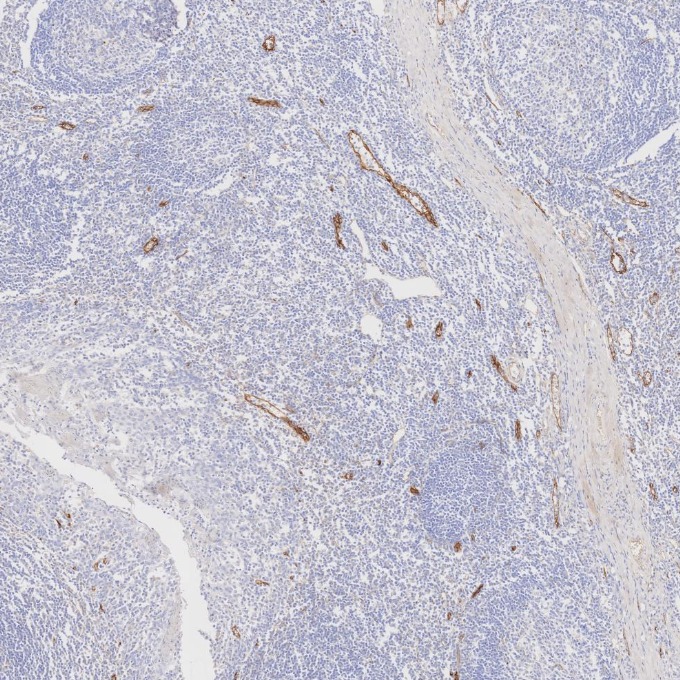 IHC staining of human tonsillitis using 82993-6-RR