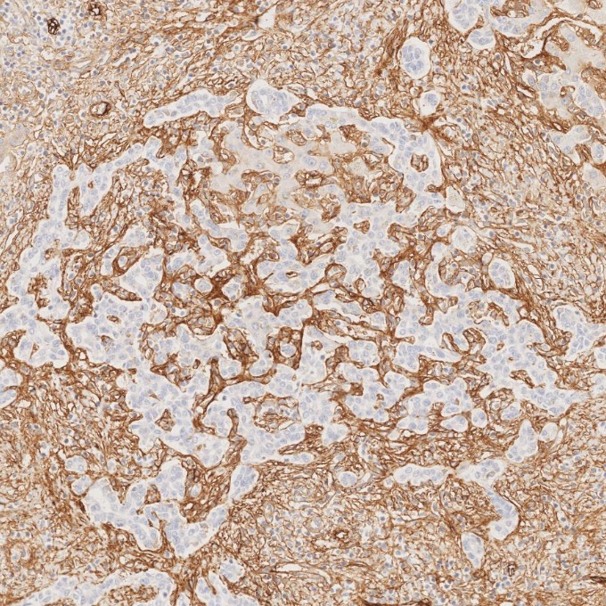 IHC staining of human liver using 82993-6-RR