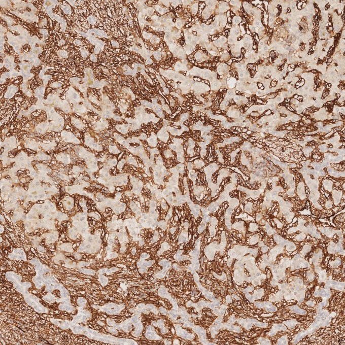 IHC staining of human liver using 82993-6-RR