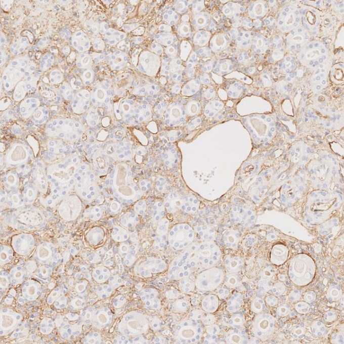 IHC staining of human kidney using 82993-6-RR