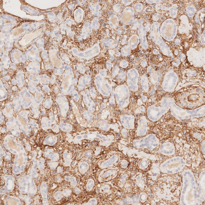 IHC staining of human kidney using 82993-6-RR