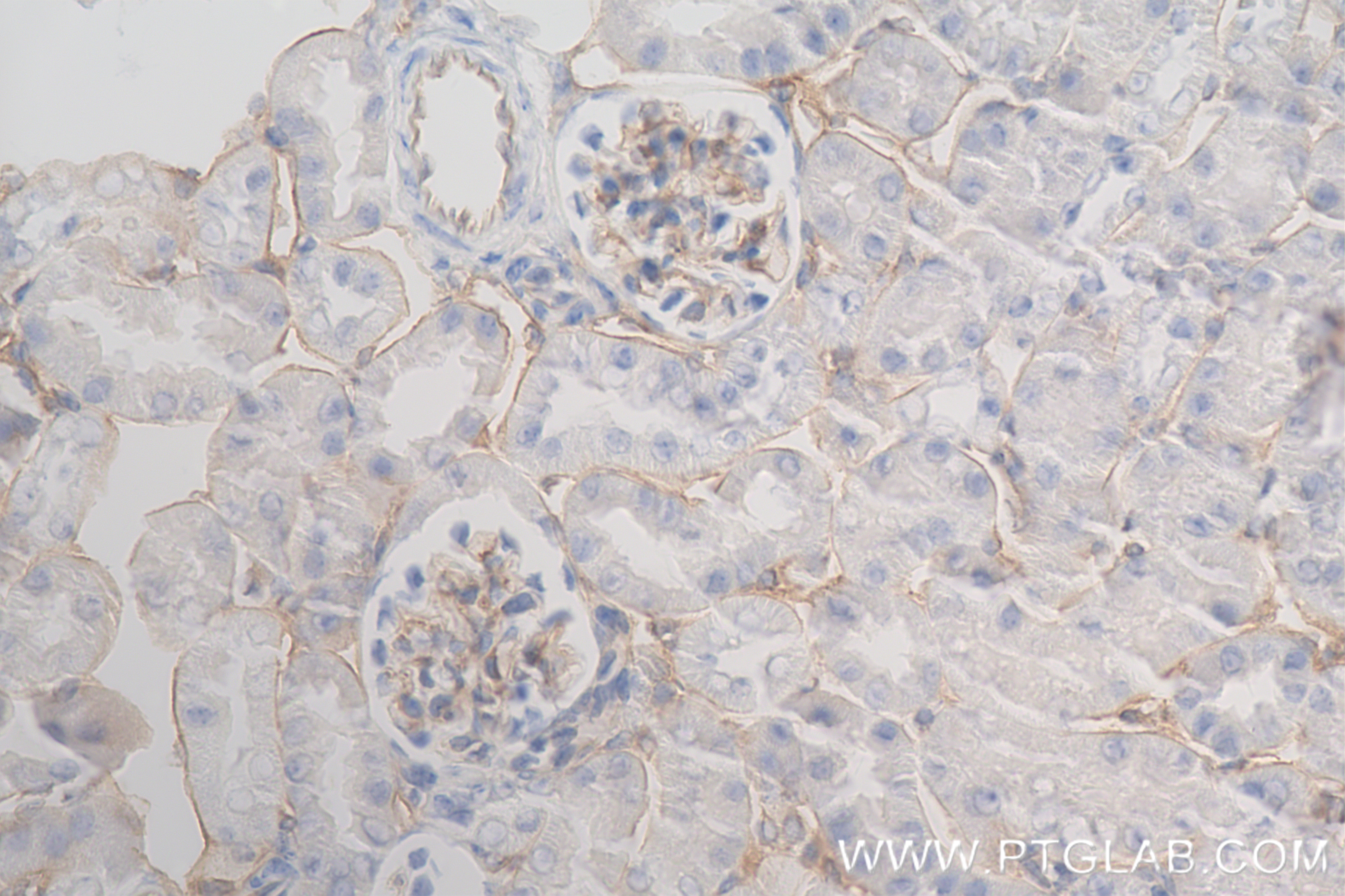 IHC staining of mouse kidney using 84807-4-RR