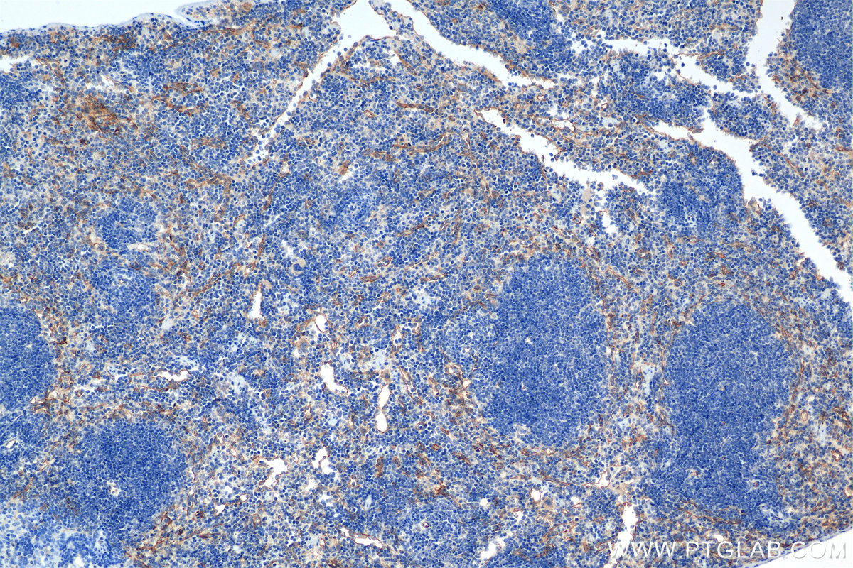 IHC staining of mouse spleen using 84807-5-RR