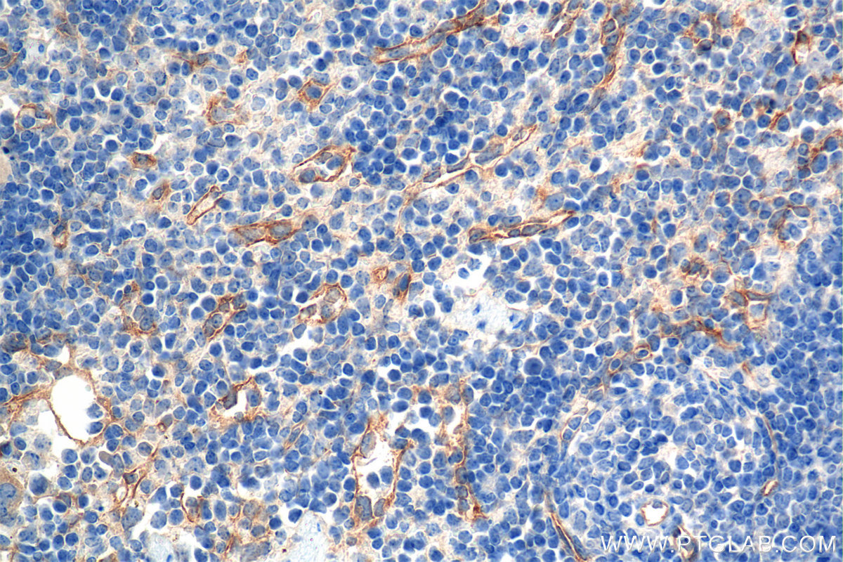 IHC staining of mouse spleen using 84807-5-RR