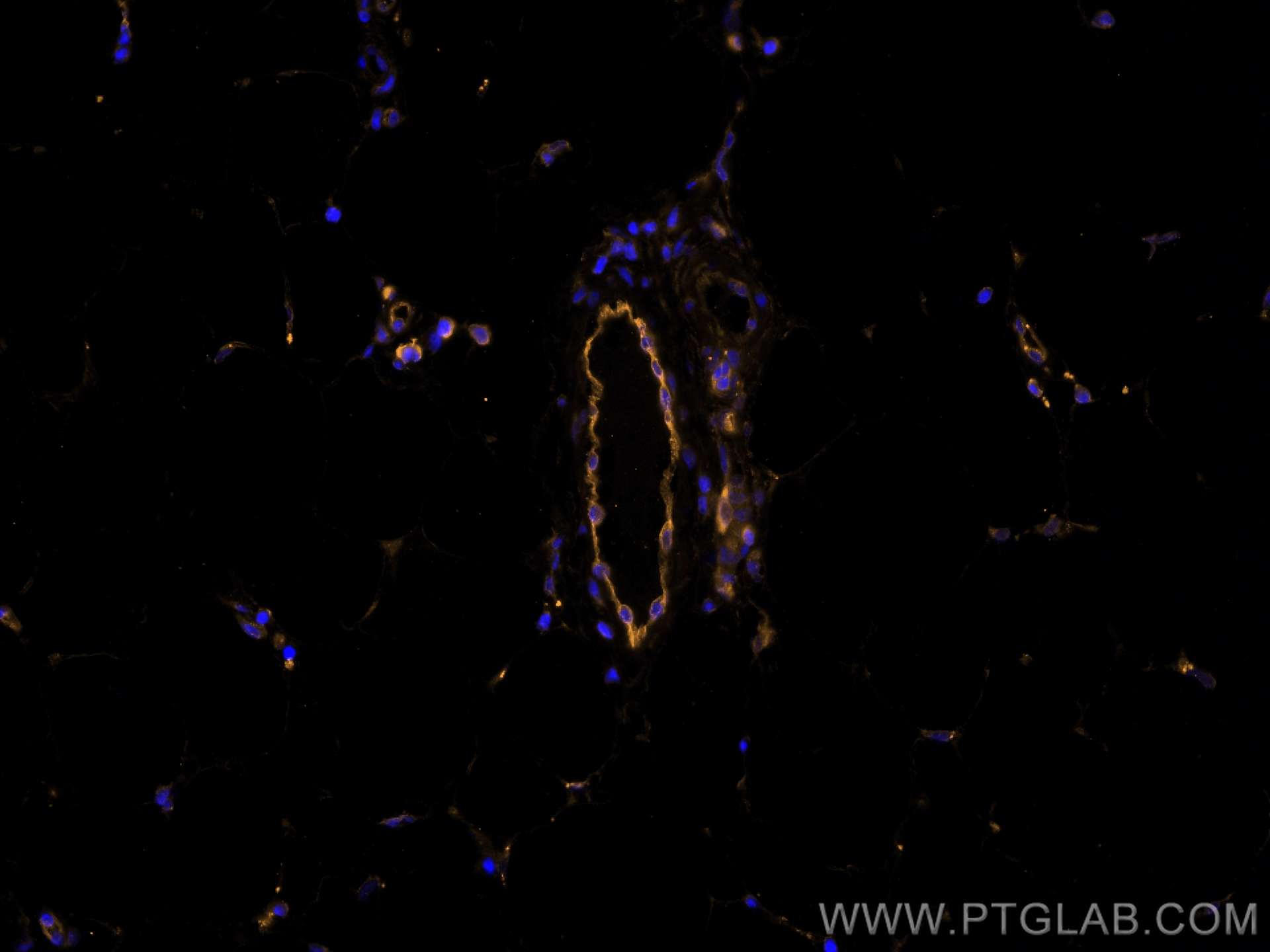 Endoglin/CD105