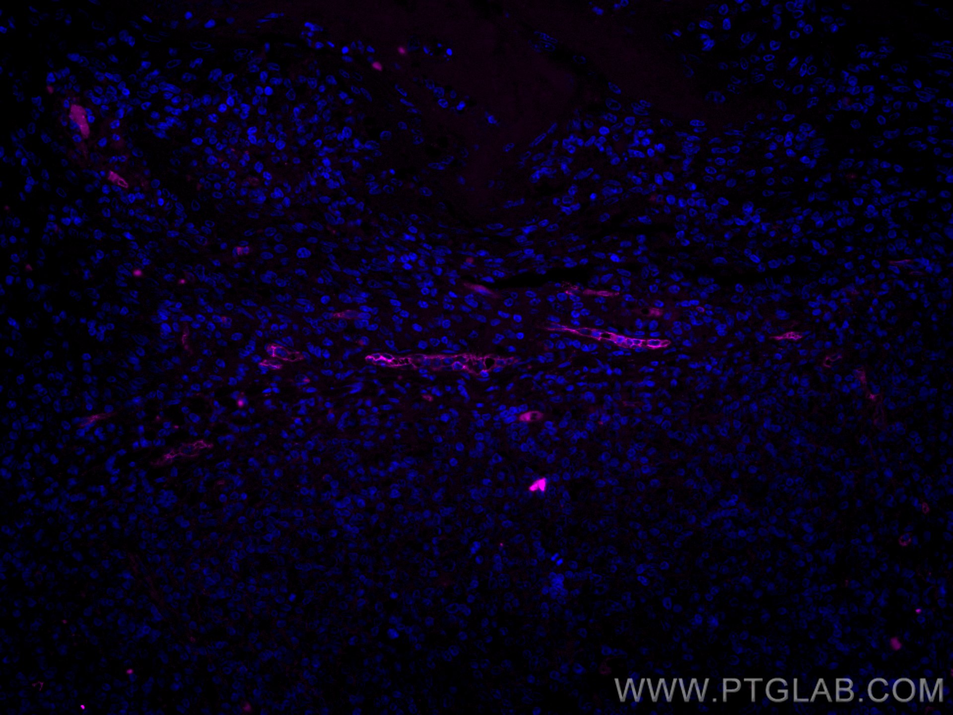 IF Staining of human tonsillitis using CL647-67075