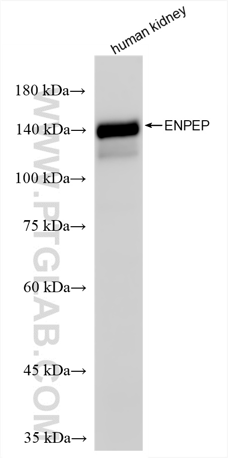 WB analysis using 86110-1-RR