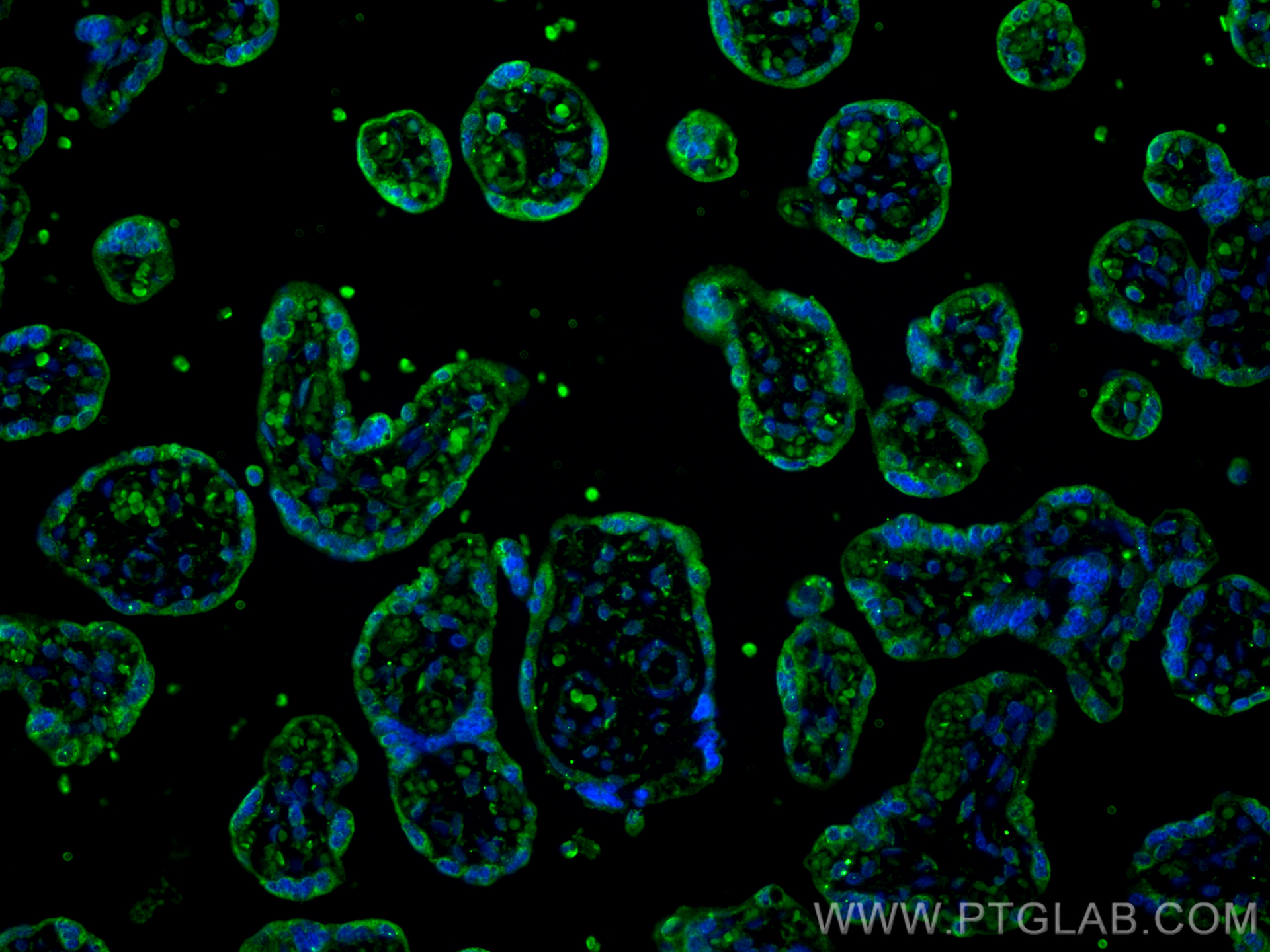 Immunofluorescent analysis of (4% PFA) fixed paraffin-embedded human placenta tissue using Entactin antibody (67310-1-Ig, Clone: 2A11G1 ) at dilution of 1:1000 and CoraLite®488-Conjugated Goat Anti-Mouse IgG(H+L) (<a class='green' href='/productredirect?CatalogNo=SA00013-1' target='_blank'>SA00013-1</a>). Heat mediated antigen retrieval with Tris-EDTA buffer (pH 9.0). IF Staining of human placenta using 67310-1-Ig