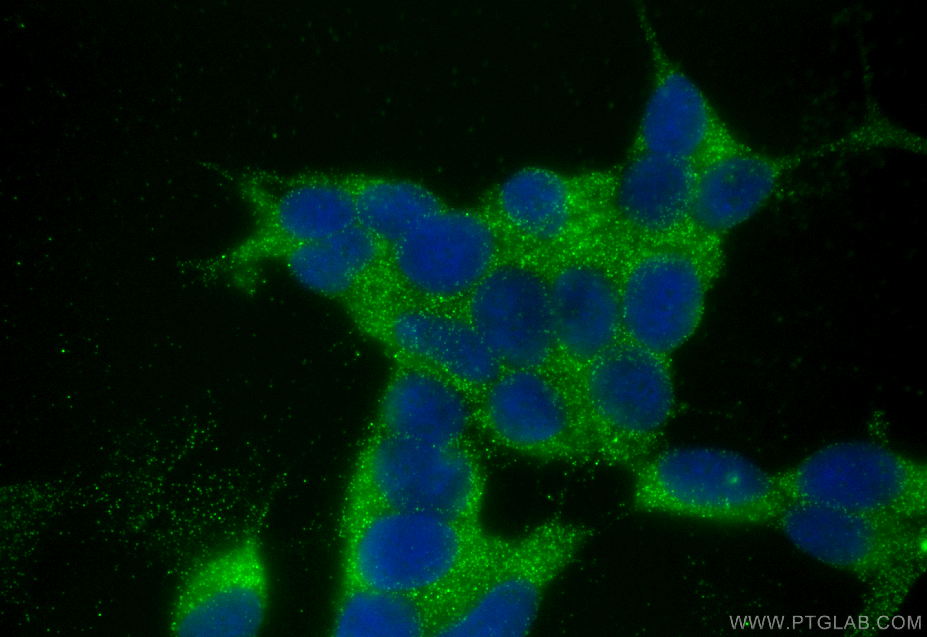 IF Staining of SH-SY5Y using 26533-1-AP