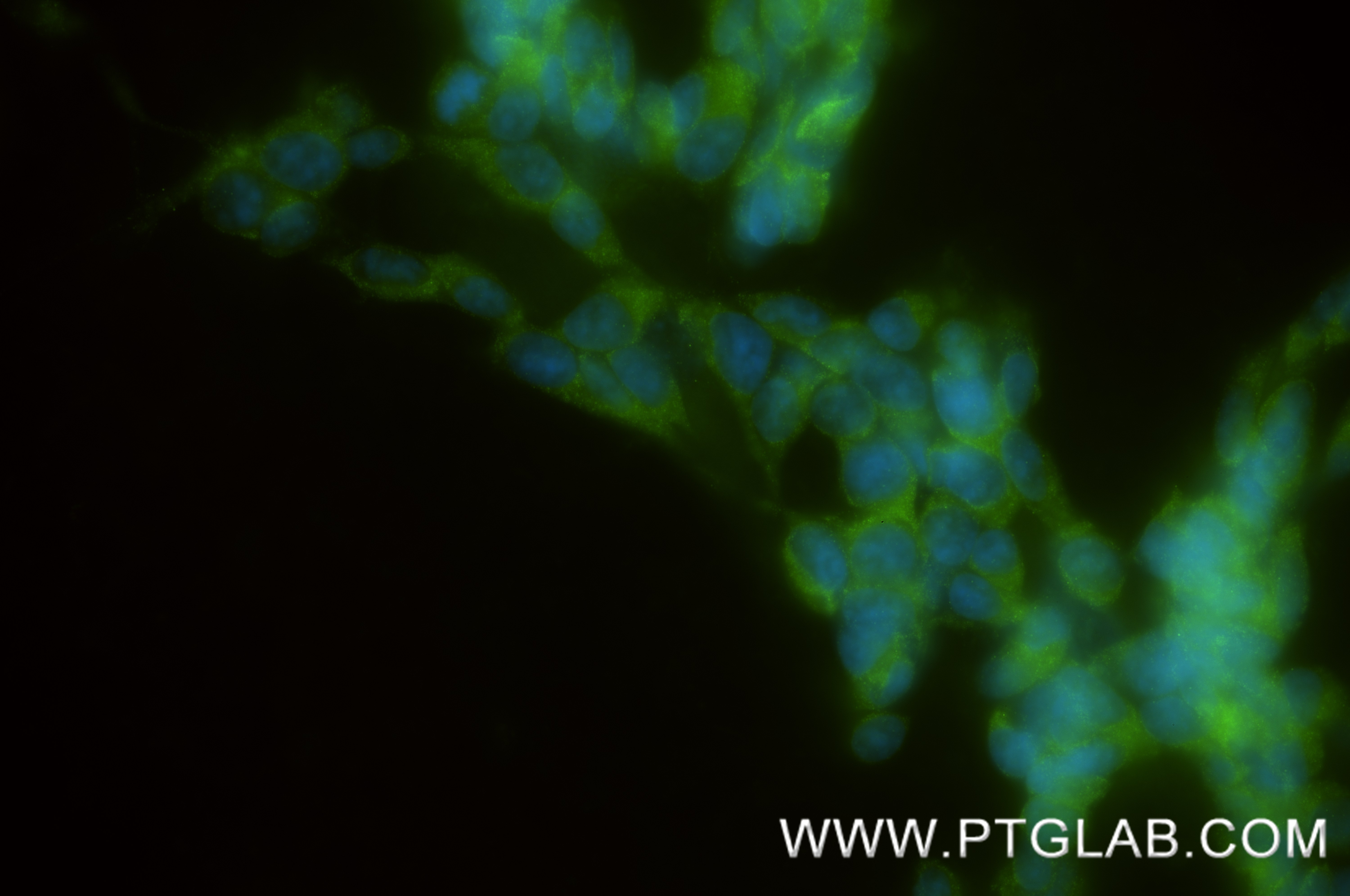 IF Staining of SH-SY5Y using 87995-1-RR (same clone as 87995-1-PBS)
