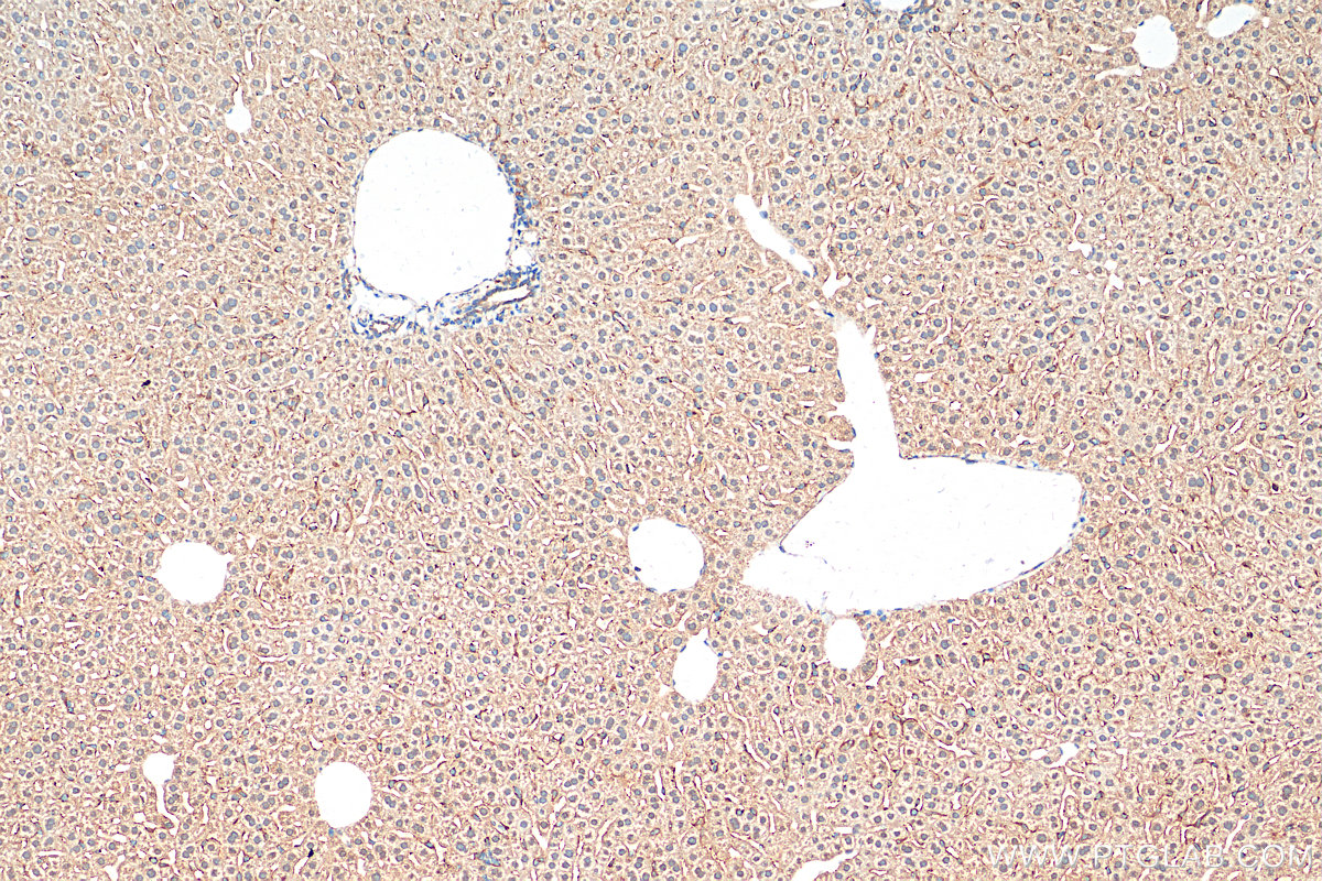 IHC staining of mouse liver using 25373-1-AP