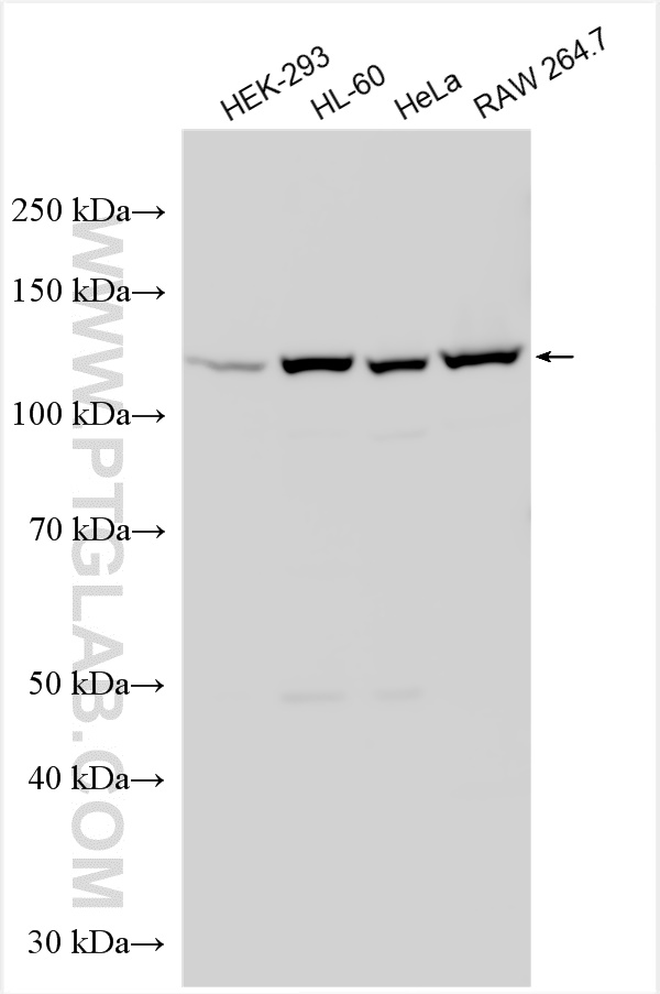 WB analysis using 25373-1-AP