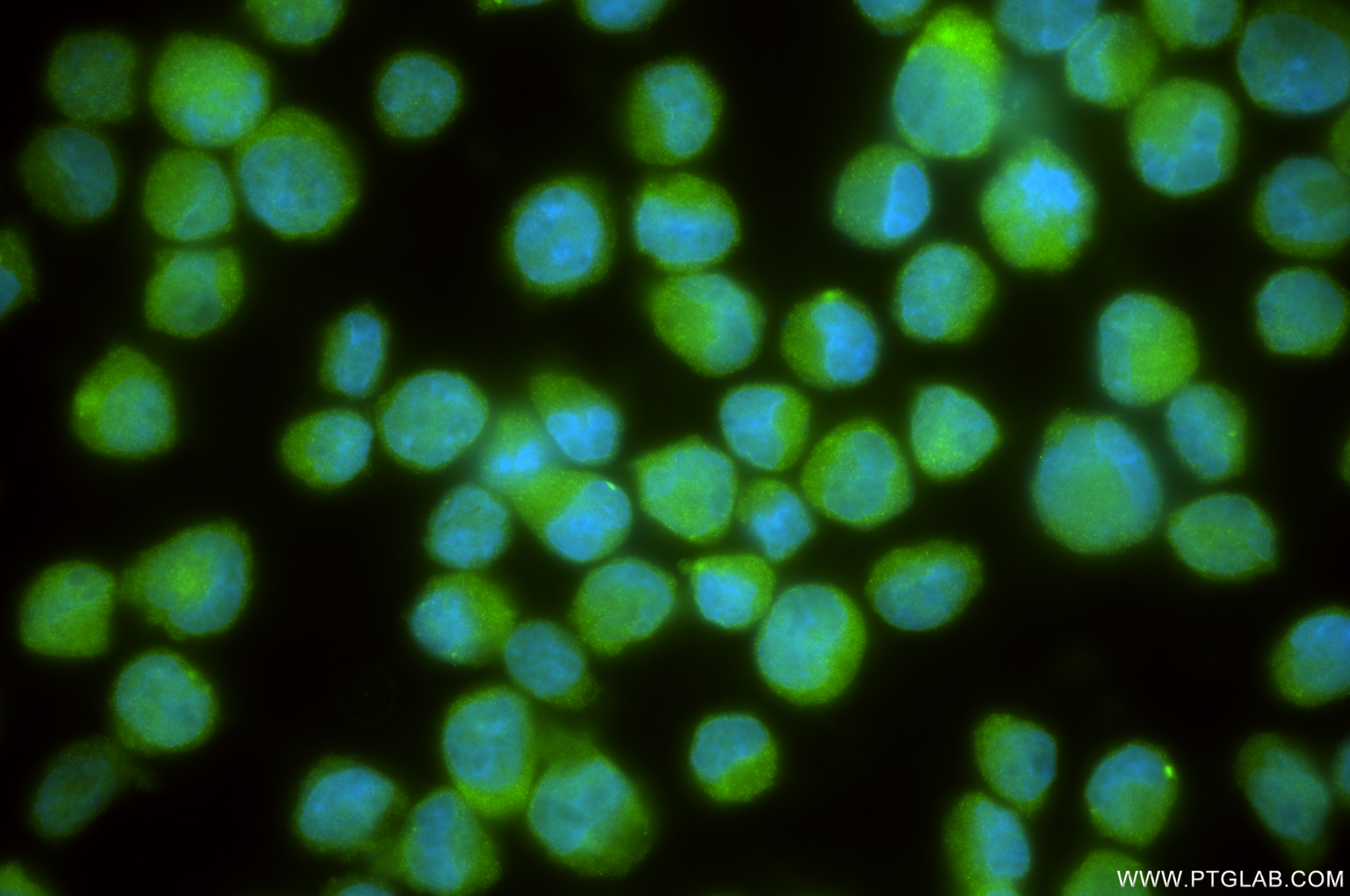 IF Staining of K-562 using 84449-1-RR (same clone as 84449-1-PBS)