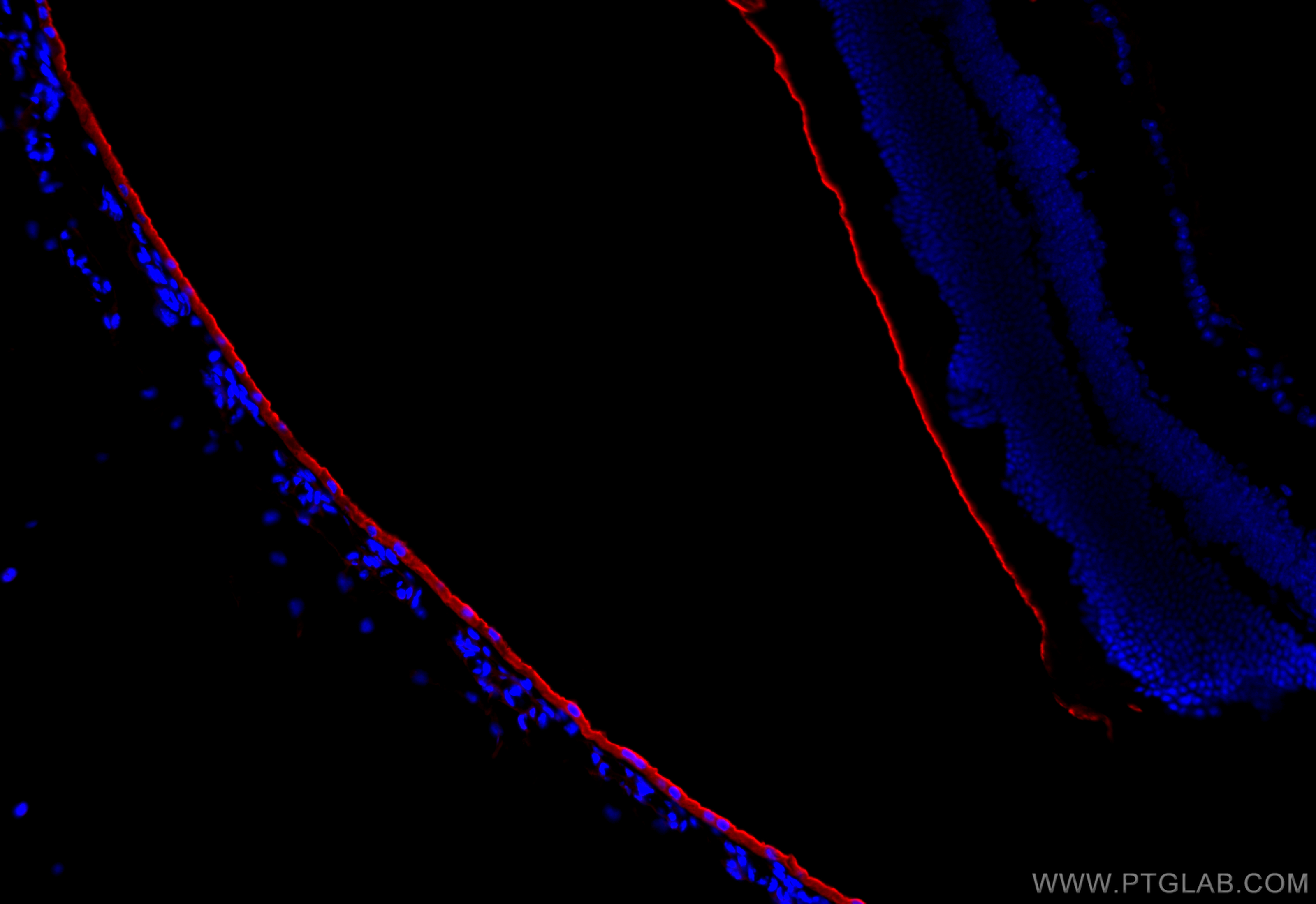 IF Staining of mouse eye using 26056-1-AP