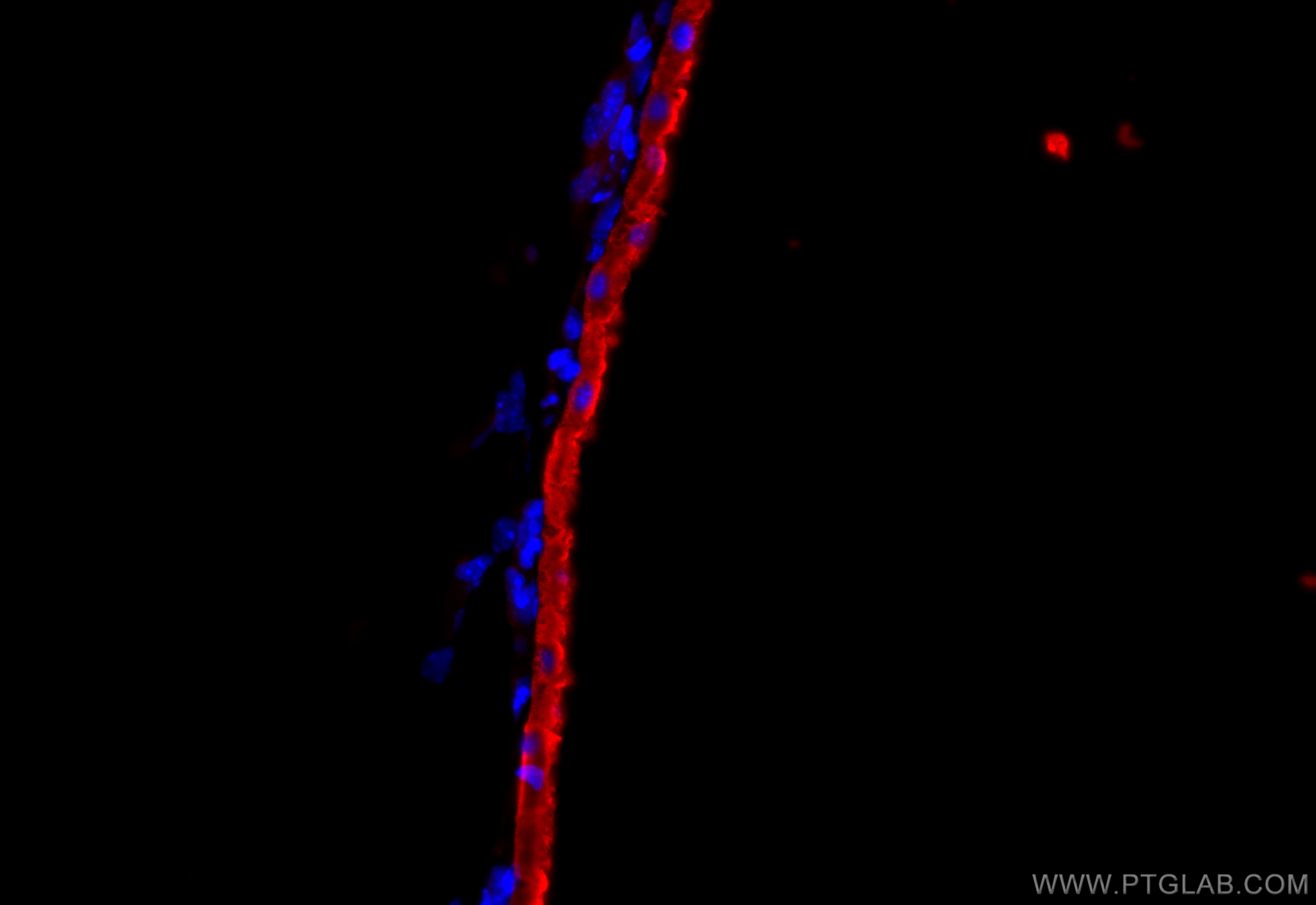 IF Staining of mouse eye using 26056-1-AP