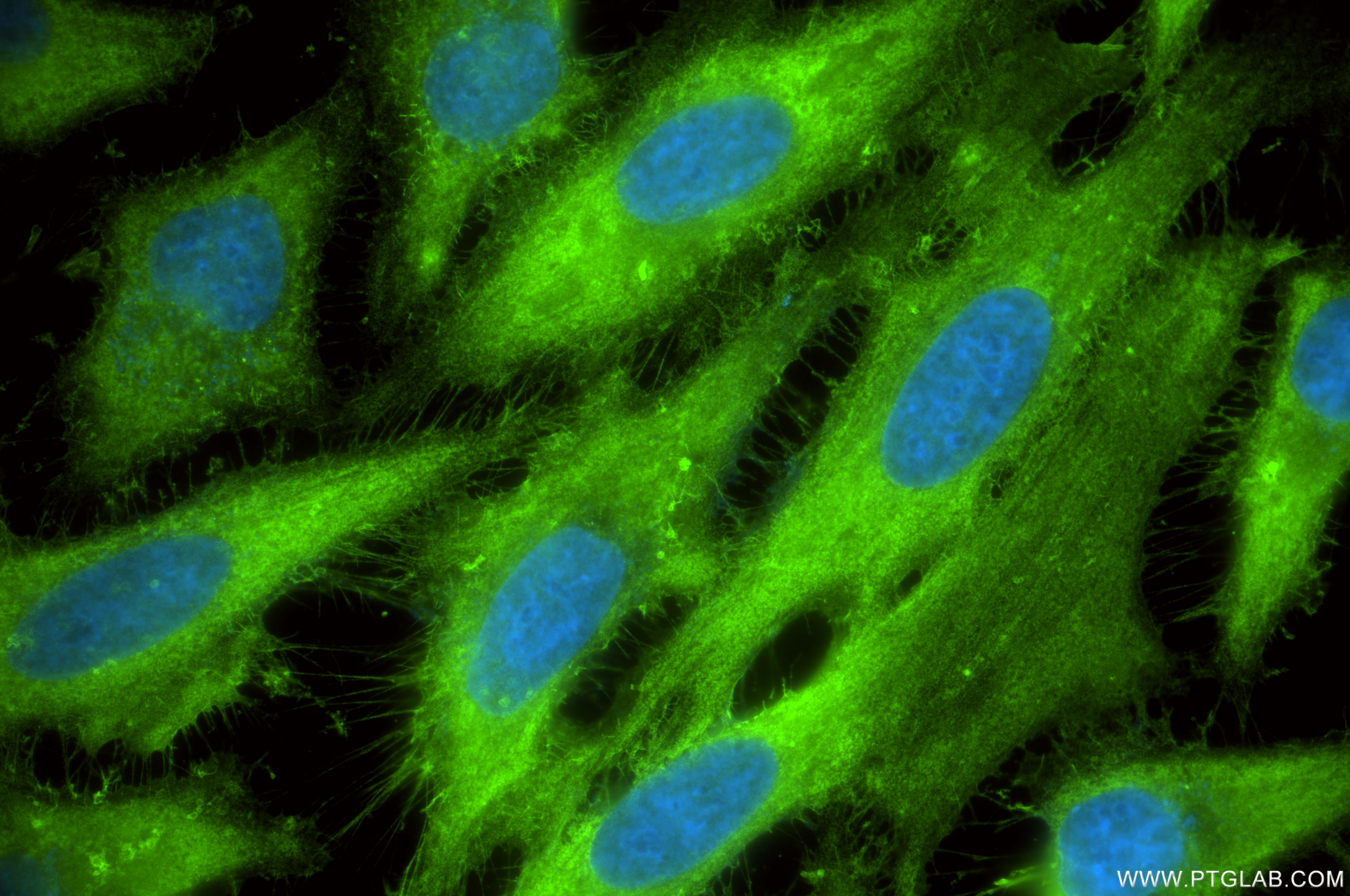 IF Staining of HeLa using 85790-4-RR (same clone as 85790-4-PBS)